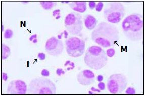 Figure 2. The somatic cell count includes macrophages (M), lymphocytes (L) and neutrophils (N).